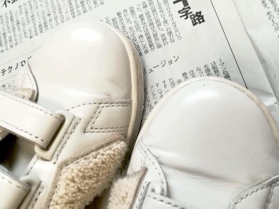 黒ずみが薄くなり、全体的にトーンアップしました